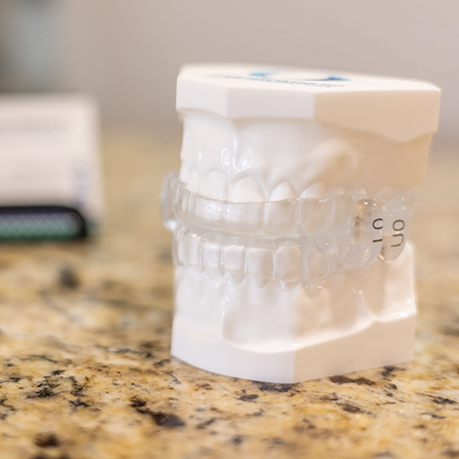 Model of the teeth with oral appliances over both arches